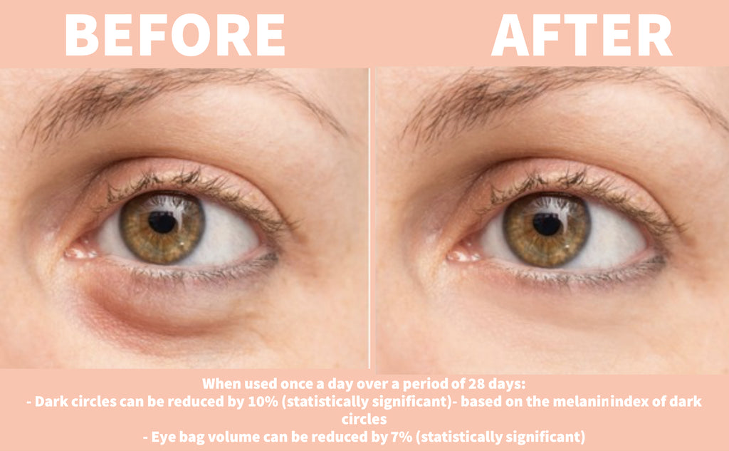 NATURE SPELL - THE EYES HAVE IT ADVANCED UNDER EYE SERUM WATERMELON GOJI BERRIES SQUALANE 30ML
