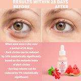 NATURE SPELL - THE EYES HAVE IT ADVANCED UNDER EYE SERUM WATERMELON GOJI BERRIES SQUALANE 30ML