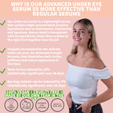 NATURE SPELL - THE EYES HAVE IT ADVANCED UNDER EYE SERUM WATERMELON GOJI BERRIES SQUALANE 30ML